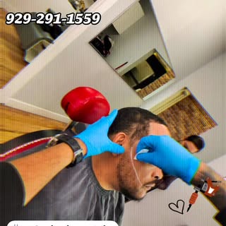 Scalp micropigmentation (SMP) is a non-surgical cosmetic procedure where tiny pigment deposits are a