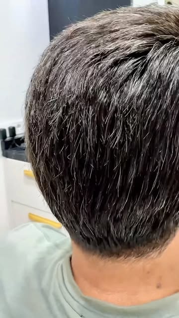PROTEZ OLDUĞUNU SÖYLEMEZSENİZ, KİMSE BİLMEK ZORUNDA DEĞİL.

Çünkü gerçek doğallık, kendini belli etm