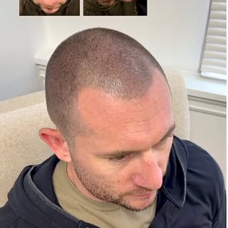 Our client wanted to keep his hair cut very short while still maintaining a little texture and softn