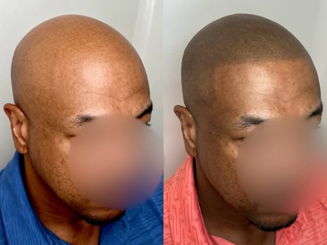A little softness at the hairline can go a long way.

Whether you prefer a crisp, defined hairline o