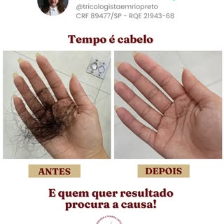 O diagnóstico vem antes do tratamento! #cabelo #tricologia #terapiacapilar #quedadecabelo