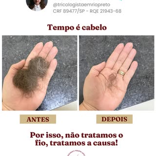 “Eu estou perdendo cabelo demais.”

Foi assim que ela chegou.

Banho. Escova. Travesseiro. Roupa.
O 