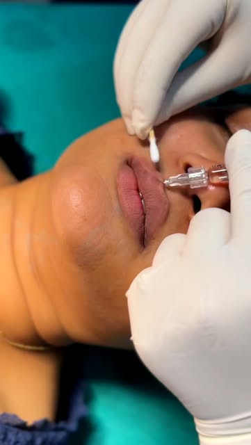 #dreamskinaesthetics #skincare #skincarenepal #dreamskin #smoothskinjourney