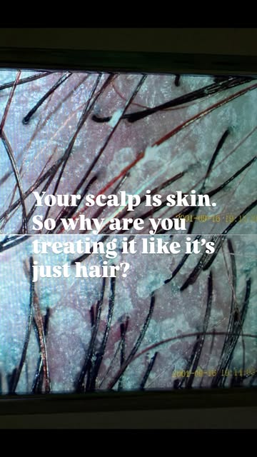 Your scalp is skin. And it deserves the same level of attention you give the rest of your skin.

Bui