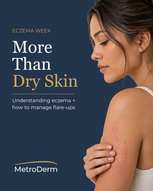 Eczema is more than just dry skin. It’s a common condition that can cause itching, inflammation and 