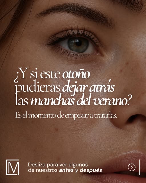 ☀️ El verano se acaba, pero las manchas pueden quedarse.

Abrimos nuestra temporada de manchas, el m