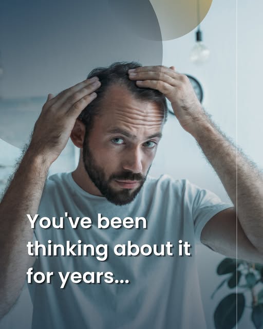 If you've been thinking about a hair transplant for years, this is your sign.
Most patients tell Dr.