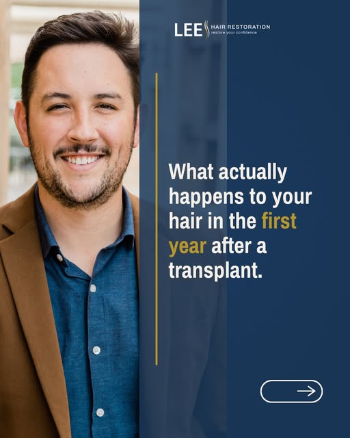 A hair transplant isn't instant,  but the wait is worth it.
Knowing what to expect at every stage ma