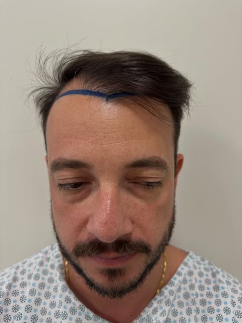 Resultado de 12 meses com naturalidade e densidade. 

As imagens apresentadas têm finalidade meramen