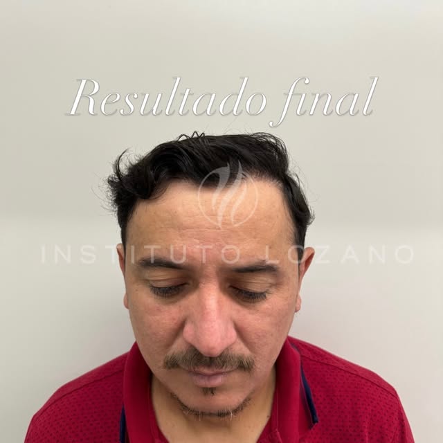 Há 12 meses começava a realização de um sonho. 
Hoje esse sonho foi concluído e o paciente totalment