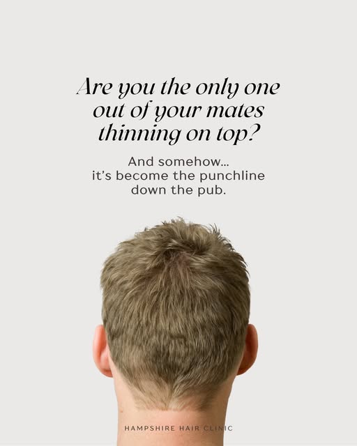 People knowing you’re losing your hair isn’t a reason NOT to do something about it.

And doing somet