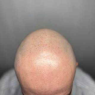 Naturel & précis

Une transformation qui ne cherche pas à se faire remarquer. 👌🏼

Merci L.

📍 Tri