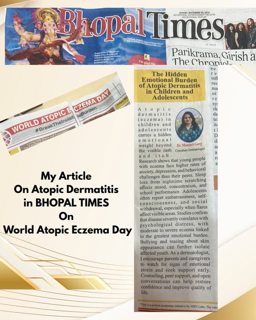 A step towards creating greater awareness about Atopic Dermatitis. 📰✨

Proud to share my article on