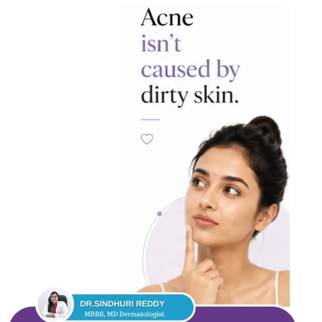 Acne isn’t a sign that your skin is dirty. 🚫🧼

Scrubbing harder or washing your face repeatedly wo