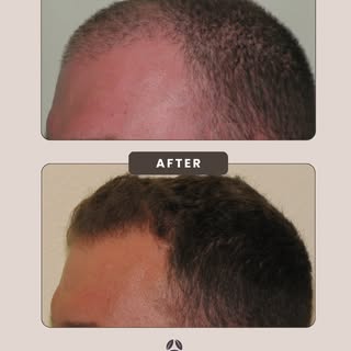When working to get more toned, you don’t see results overnight.
Skincare doesn’t immediately correc