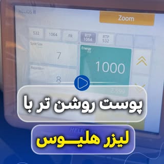 ⁨	⁨	⁨	⁨	⁨	⁨	✨ پوست روشن‌تر، لک‌های کم‌رنگ‌تر و شادابی بیشتر…
فقط با چند دقیقه لیزر Helios III 💫

لی