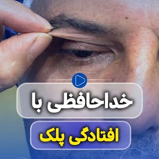 ⁨	⁨	⁨	افتادگی پلک داری؟
این تست ساده کمک می‌کنه بفهمی.

❗️اگر پوست پلک را بالا بدهید و دیدتان بازتر 