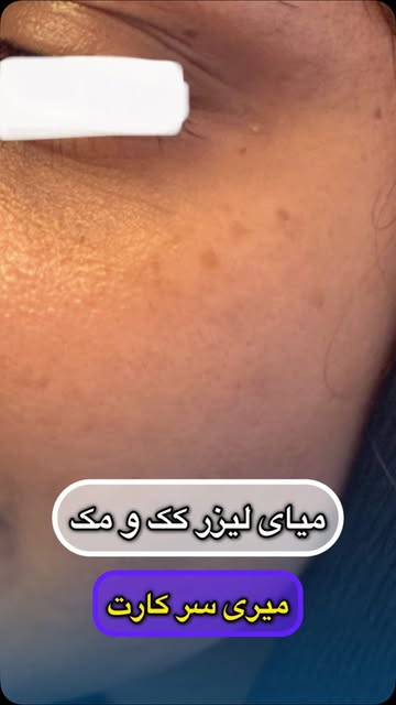 ⁨	از سرکار بیا، هلیوس ۳ انجام بده، دوباره برگرد سر کارت! 👀

فکر می‌کنید برای درمان کک‌ومک و جوانساز