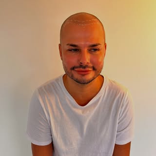 Scalp Micropigmentation, hair tattoo
“🌟 Embracing change starts with understanding your journey. Ha