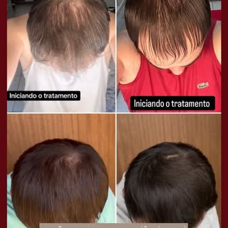 O segredo para um tratamento capilar de sucesso não está em soluções genéricas, mas sim em um protoc