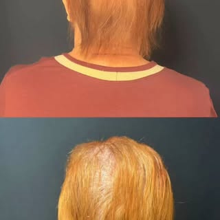 Esse é um caso muito especial para mim.

Uma história que carrega significado, confiança e um desejo