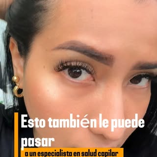 Sé lo que se siente ver menos cabello en el espejo 🥺
No desde la teoría… desde vivirlo.
La pérdida 