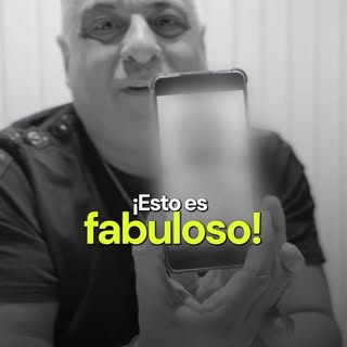 1 año y medio de Microtrasplante Capilar de @marceloiripinook 

Los resultados están a la vista 💪

