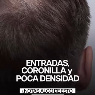 ¿Alguna de estas situaciones te resulta familiar? 👀

Entradas más marcadas, menor densidad en la pa