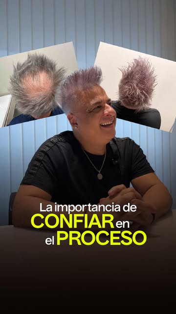 CONFIAR EN EL PROCESO💪
@marceloiripinook luego de 1 año de su Microtrasplante capilar en Hair Recov
