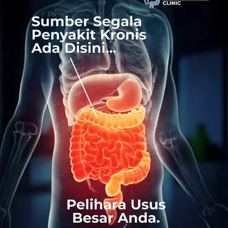 Sumber hampir semua penyakit kronis untuk pencernaan dan tubuh anda ada di usus besar (colon) yang b