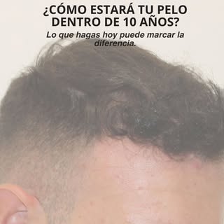 ¿Cómo estará tu pelo dentro de 10 años?

Es una pregunta que casi nadie se hace… hasta que empieza a