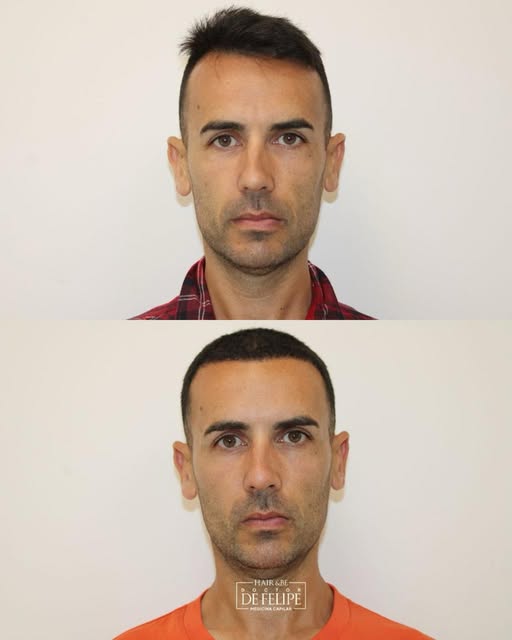 Hay cambios que no buscan llamar la atención.

Buscan que todo vuelva a encajar.

En este caso, el o