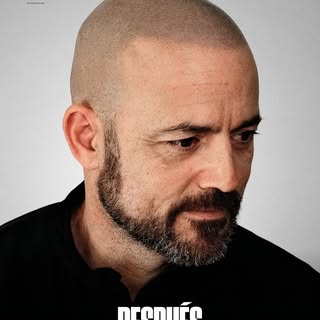 Miguel no tenía complejo por tener alopecia. Eso no quiere decir que le gustara verse así. Simplemen