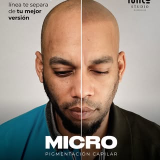 Hay soluciones que disimulan… y otras que realmente cambian cómo te ves y cómo te sientes.
La microp