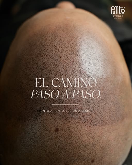 Una micropigmentación capilar no se trata solo del resultado final. El proceso es parte del resultad