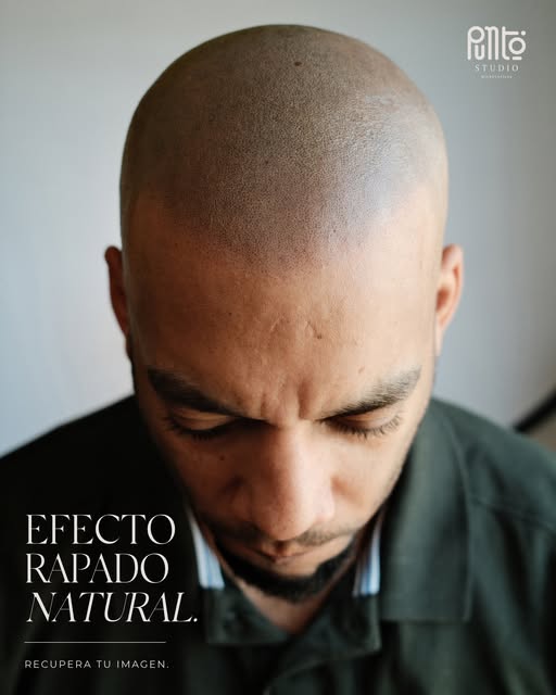 ¿Y si pudieras recuperar el efecto de un rapado natural?

La micropigmentación capilar recrea visual