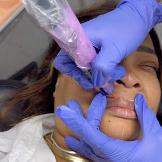 Just a sneak with our new @biomaserofficial machine. We’re absolutely IN LOVE!