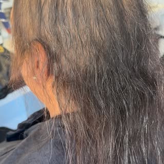 I can’t tell you how much love I get from customising these mesh integrations for my hair loss clien
