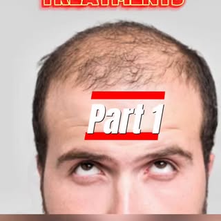 Hair loss might finally meet its match 💥 These 3 future treatments could be game-changers. Would yo