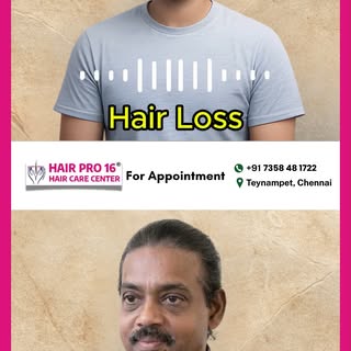 Hair loss can affect confidence, but the right treatment can change everything.

Watch this real tra