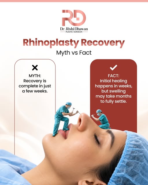 Rhinoplasty Recovery: What to Expect

Rhinoplasty doesn’t fully heal in just a few weeks.

• Initial