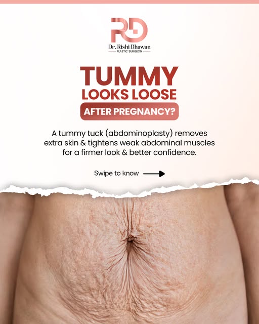 Loose skin or weakened abdominal muscles after pregnancy?

Pregnancy can change the abdominal area i