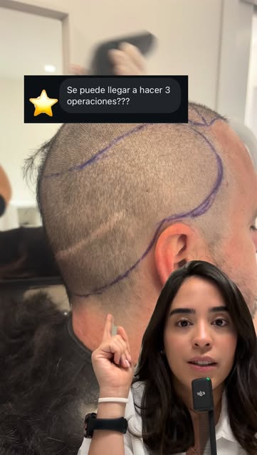 ¿Puedo hacerme más de 1 cirugía? 🤯

Sí. Pero eso no significa que siempre esté indicado.
 
Para tom