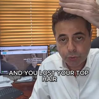 Hair Transplant Result with 5000 FUE Grafts in a Norwood 6 Patient! 
🌐 www.hairtransplants-hdc.com
