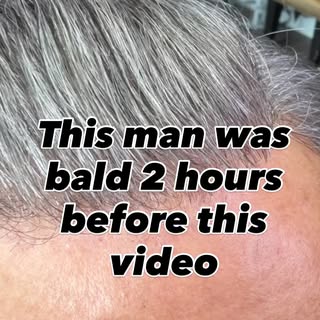 Most guys’ biggest fear with a hair system? “What if someone notices?”

Truth is — when it’s done ri