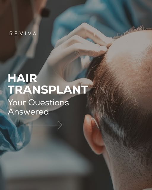 Thinking about a hair transplant? 💭 We've answered some of the most common questions to help you be