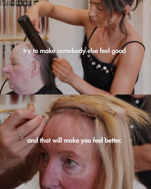 Hair loss carries a mental load that I don’t think people fully understand until they’ve lived it…

