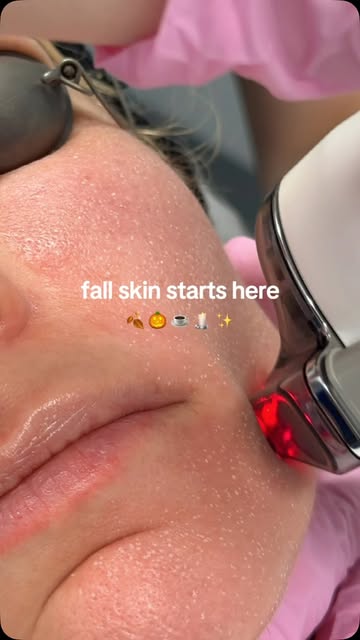 Fall is officially laser season 🍂✨ Less sun, more glow. Halo season is here 🤍

#halo #esthetician 