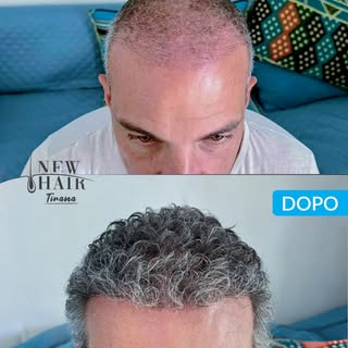 Linea frontale ridefinita e densità uniforme per un risultato naturale 💫
Questi sono i dettagli che