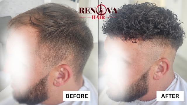 🔥 Who said a hair system has to look straight and flat?

This before & after transformation shows j